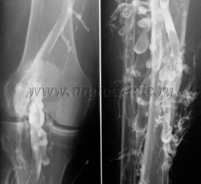 Сканкунии ултрасадо