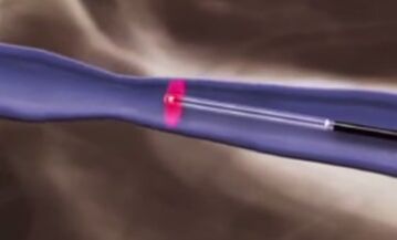 Табобатҳои гармидиҳӣ